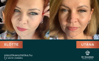 Végre kicsit figyelhetek magamra