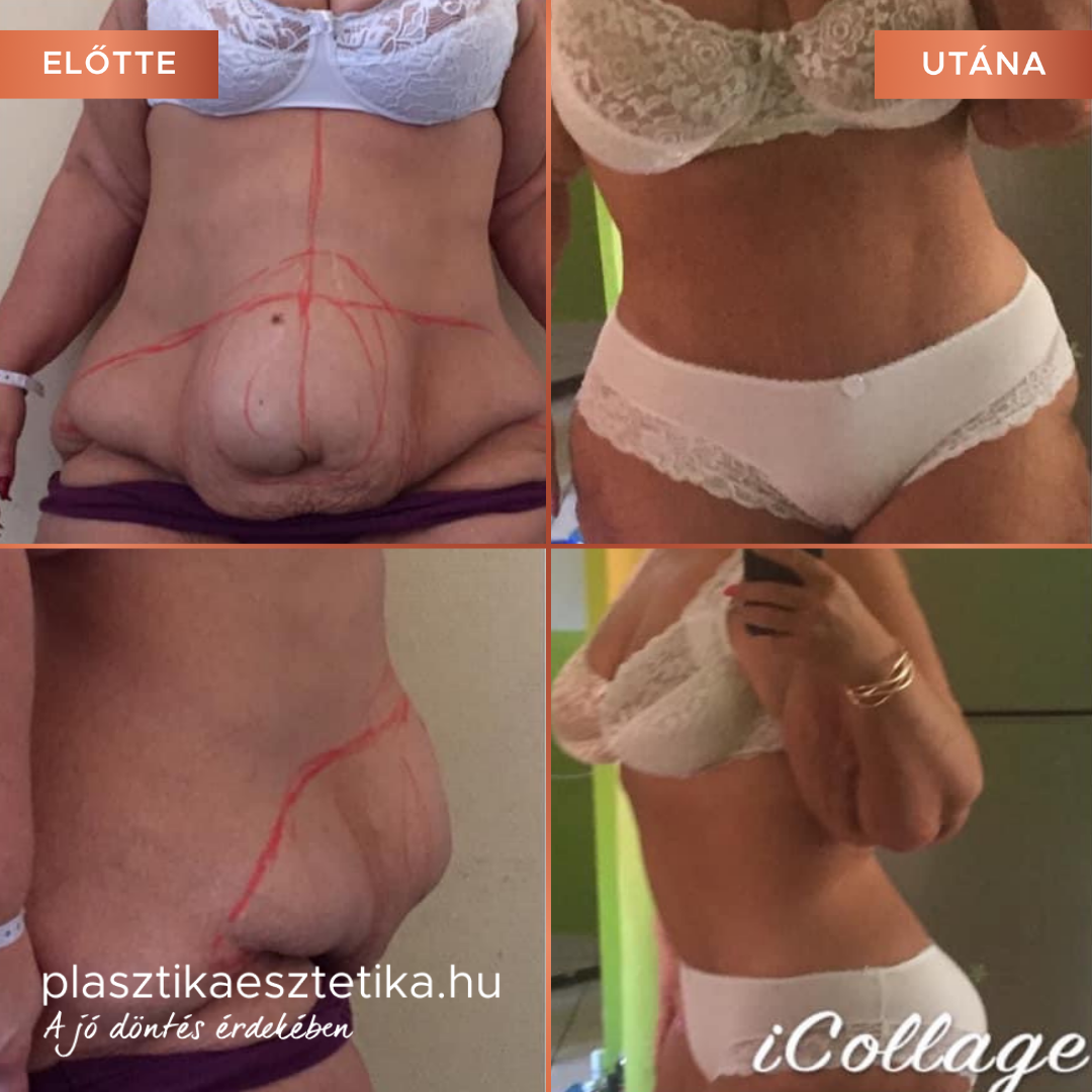 Remekül érzem magam. Imádom az új hasamat!