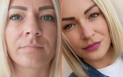 Büszke vagyok az ajkaimra, amik sokkal teltebbek és nőiesebbek lettek!