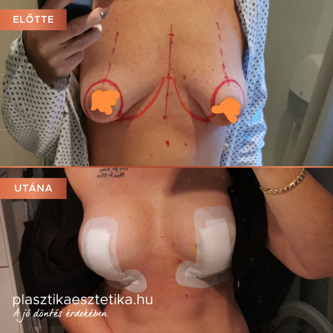 Tökéletesen, sokkal rosszabbat vártam