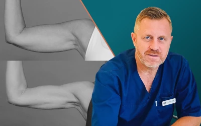 Jelentős változások hegek nélkül: bemutatjuk az InMode-kezeléseket!