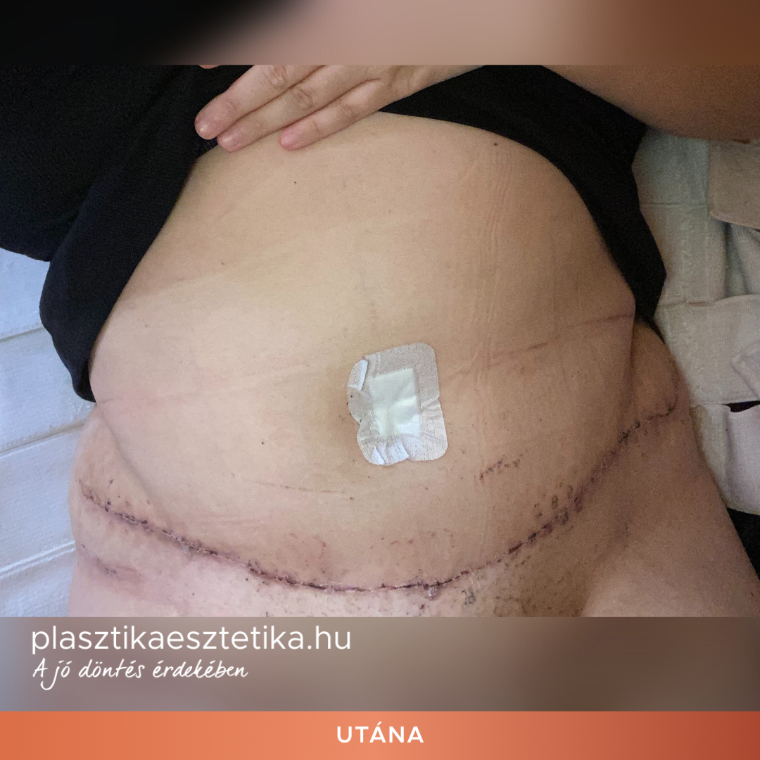 Teljesen jól, doktor úr vissza adta az önbizalmam