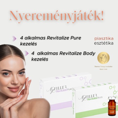 Nyerj Revitalize kezeléseket!