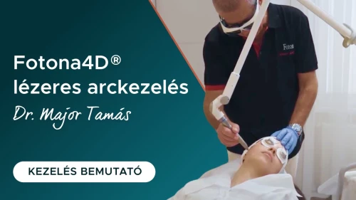 Fotona4D® lézeres arckezelés Dr. Major Tamással