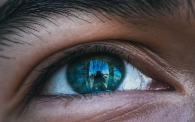 Kiknek ajánlott a szemhéjplasztika?