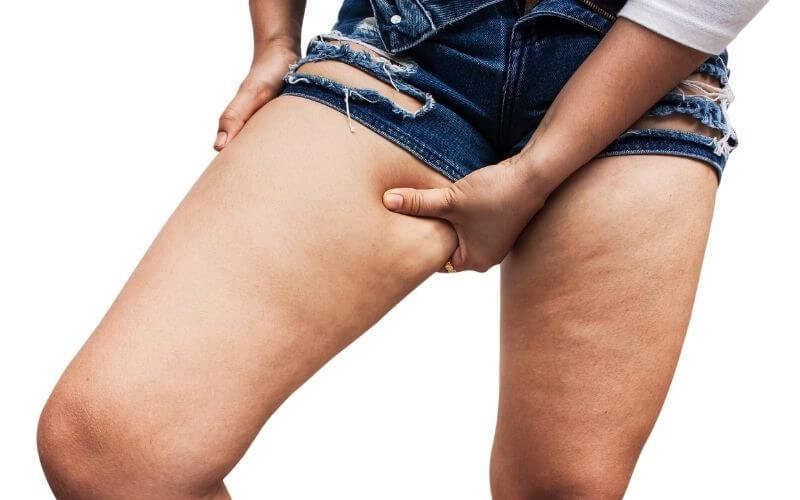 A nők rémálma: az előnytelen combok