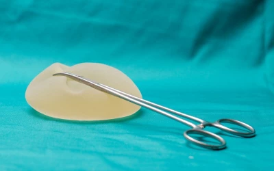Valóban szükségem van mellimplantátum cserére?