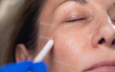 5+1 dolog, amit érdemes tudnod a szálbehúzásról